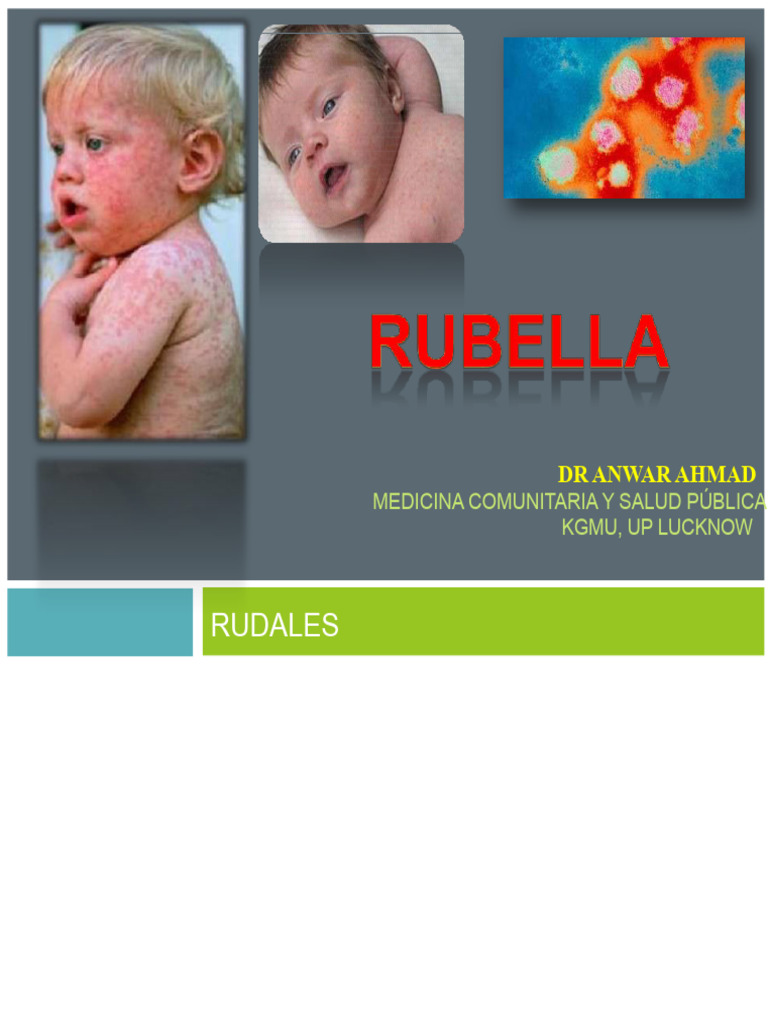 Historia y Epidemiología de la Rubéola | PDF | Sarampión | Virus