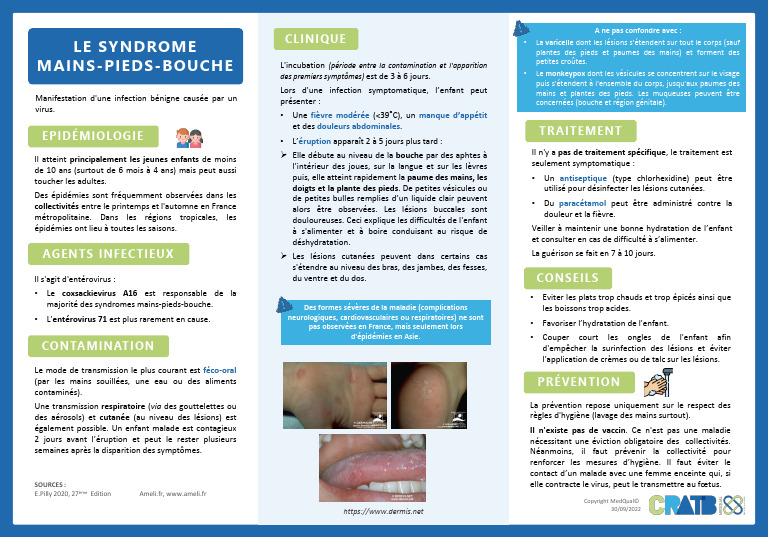 Comprendre Le Syndrome Mains pieds bouche PDF Sant Publique 