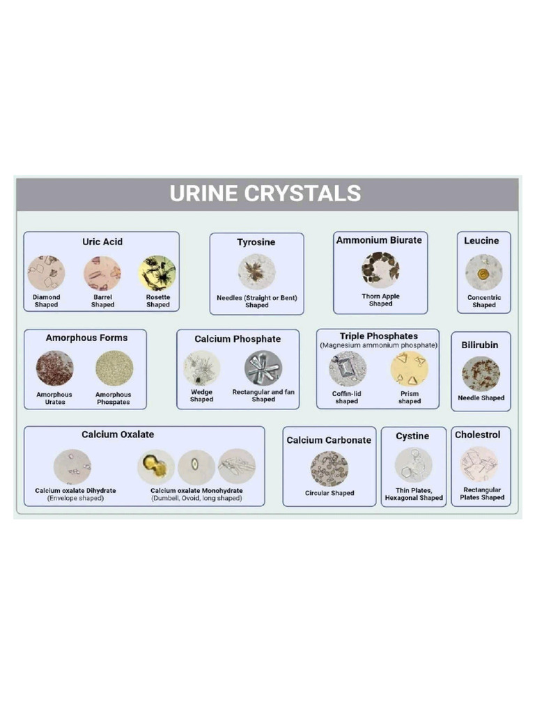 Urine Interpretation 30 Good | PDF