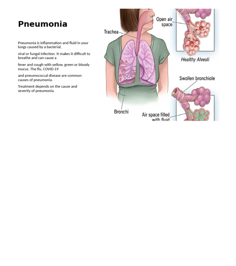 Pneumonia | PDF