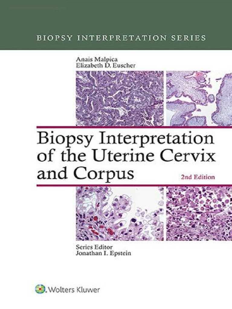 BIS-Biopsy Interpretation of The Uterine Cervix and Corpus | PDF ...