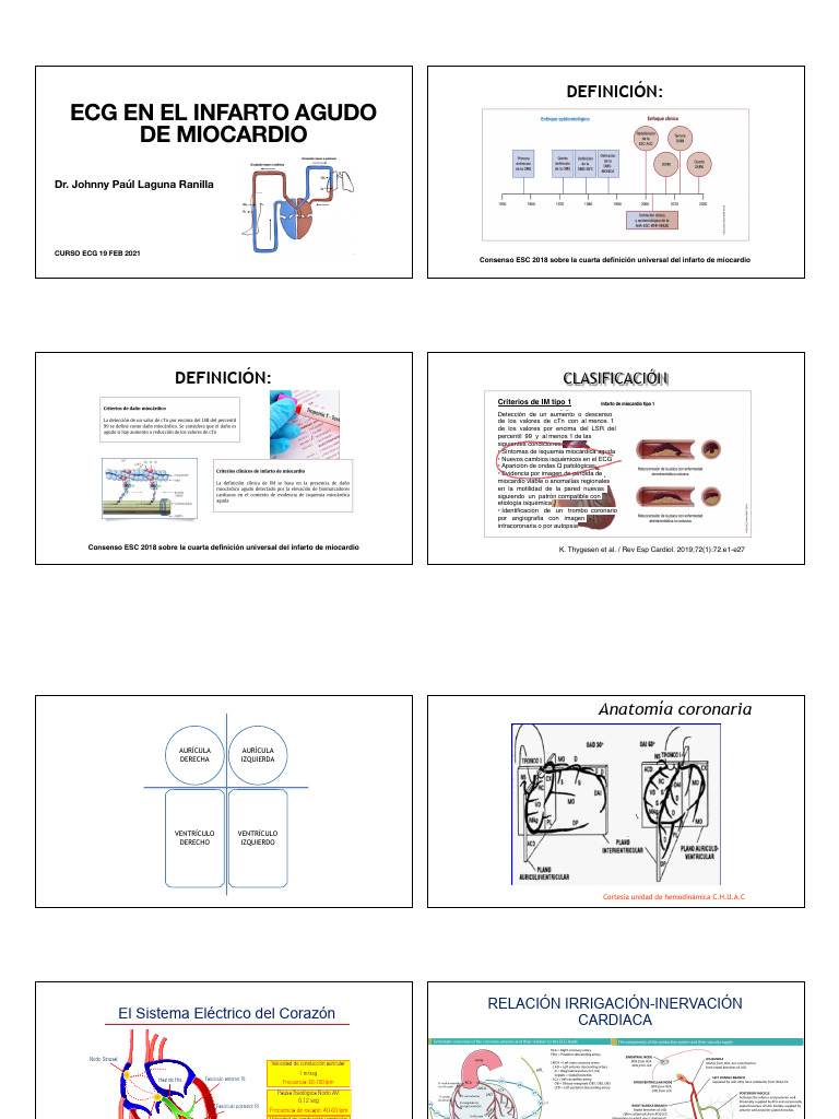 Ecg en Ima | PDF | Infarto de miocardio | Isquemia