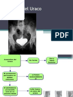 Anomalias Del Uraco