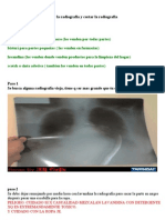 Como Lavar La Radiografia y Cortar La Radiografia