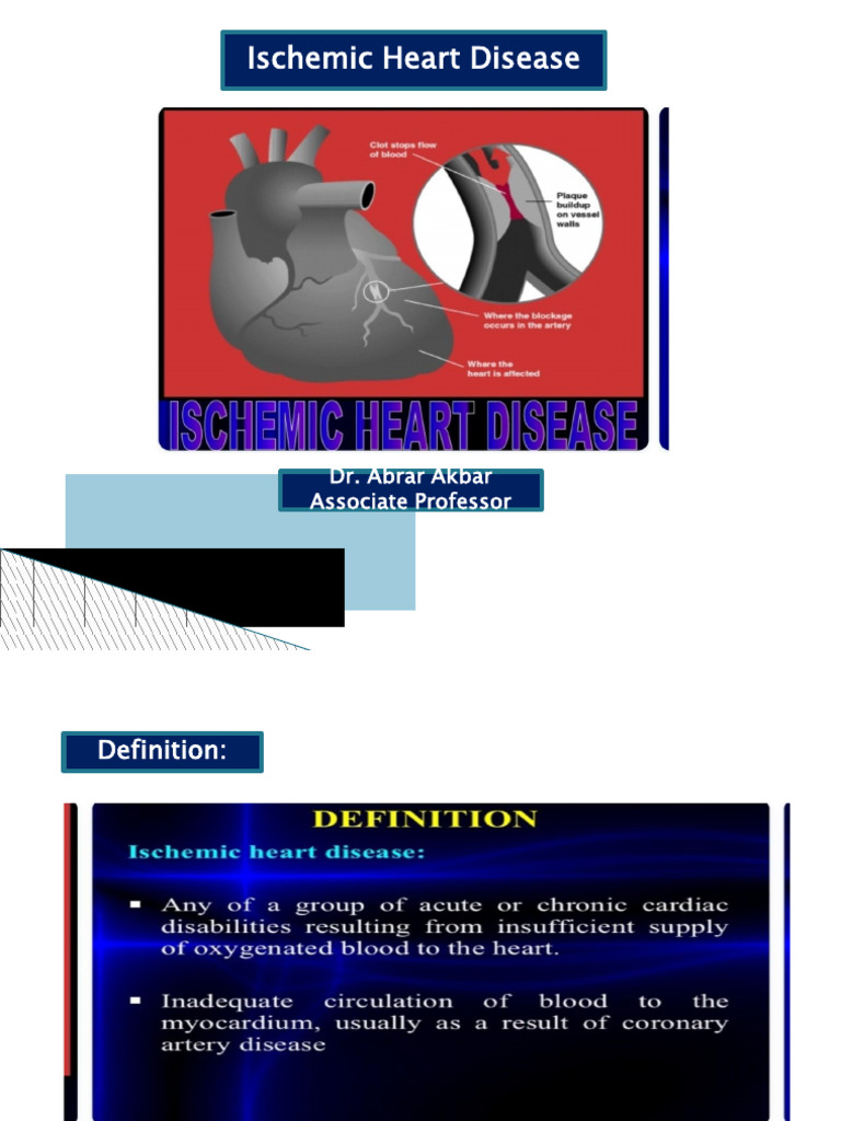 Ischemic Heart Disease | PDF