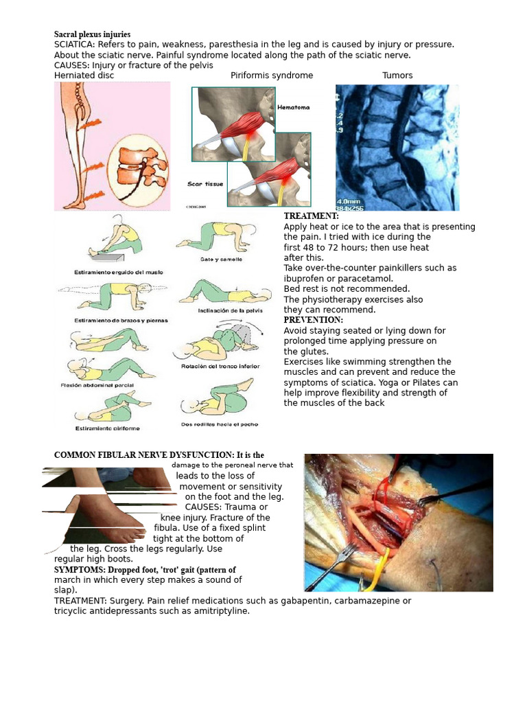 Sacral Plexus Injury Overview and Treatment | PDF | Lower Limb Anatomy ...