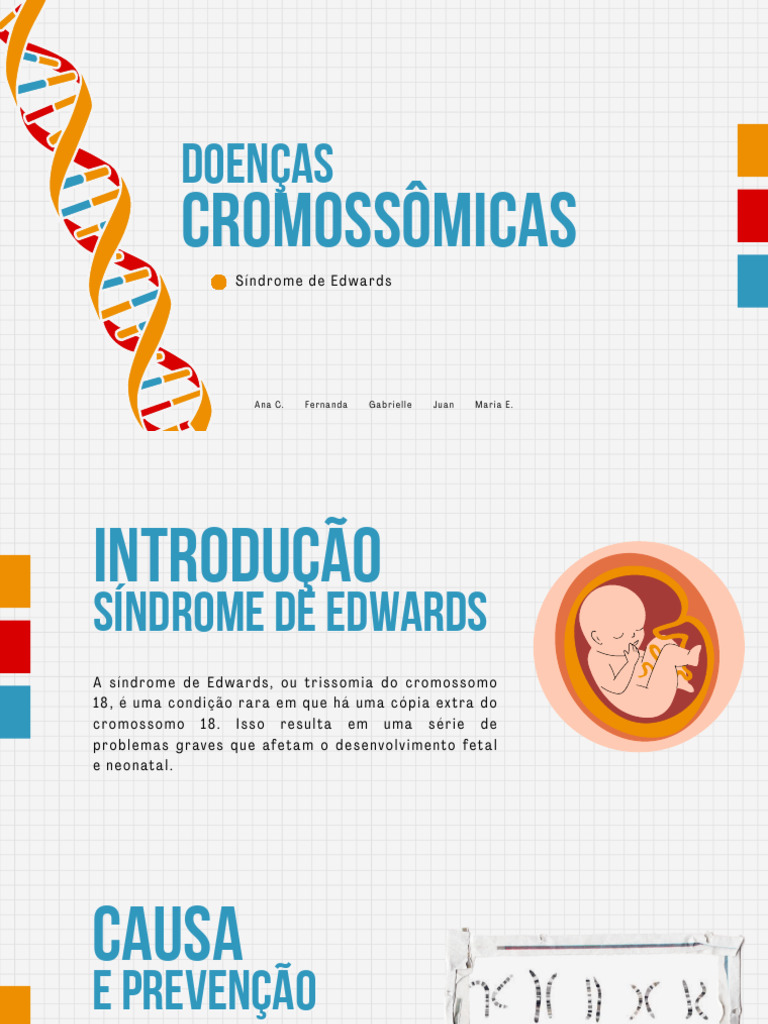 Síndrome de Edwards | PDF | Doença genética | Síndrome