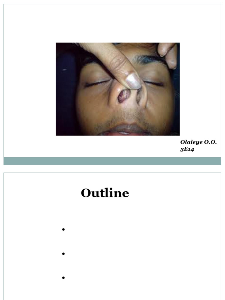 Nasal Cavity2024 | PDF | Human Nose | Primate Anatomy