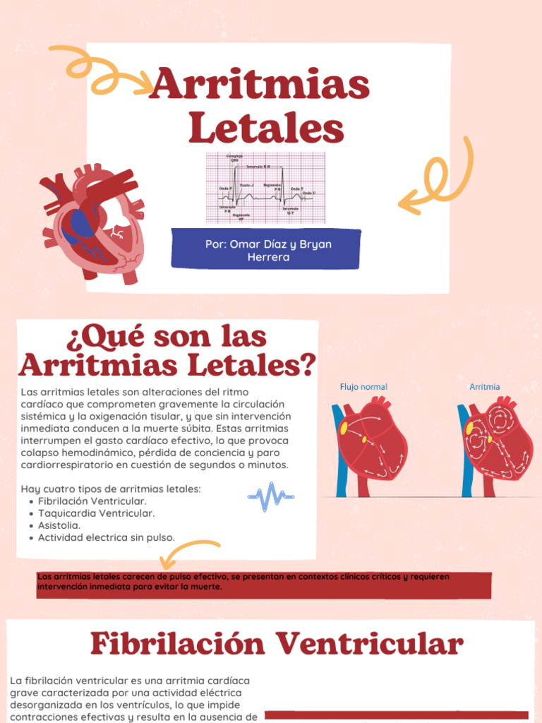 Arritmias Letales: Tipos y Diagnóstico | PDF | Corazón | Sistema ...