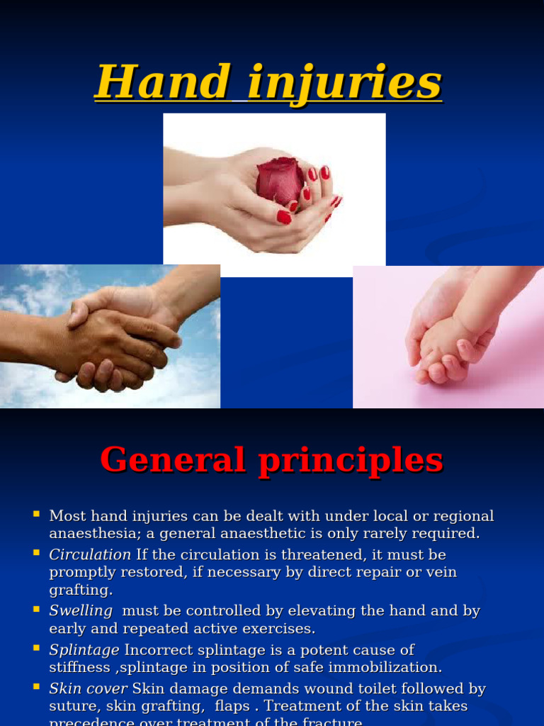 Hand Injuries | PDF | Hand | Thumb