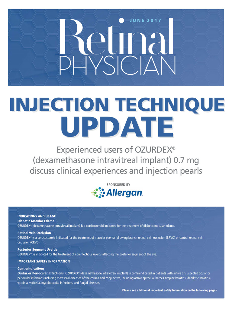 OZURDEX® Uses and Safety Overview | PDF | Ophthalmology | Human Eye