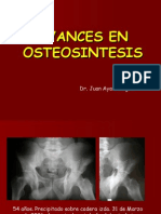 Avances_osteosintesis