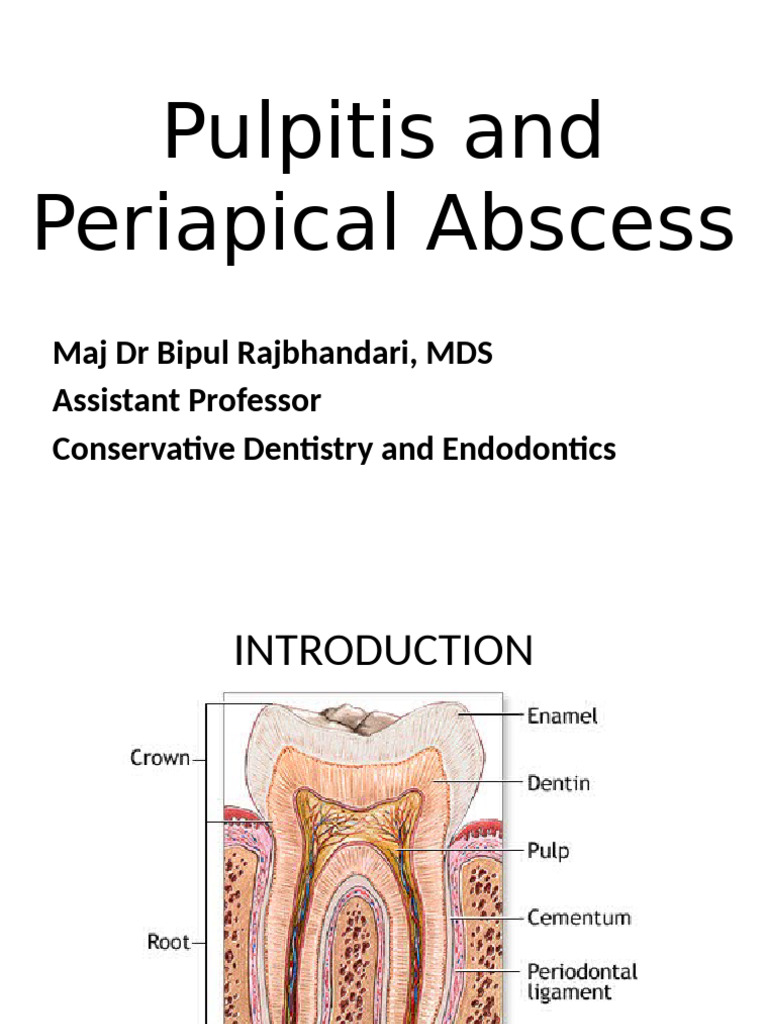 Pulpitis and Periapical Abscess Overview | PDF | Dentistry Branches ...