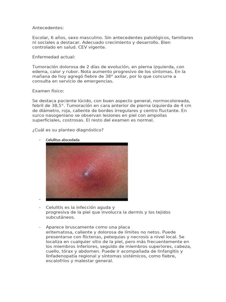 TUMOR AXILAR DE ORIGEM NEURAL: UM ACHADO INCOMUM, image size:768x1024