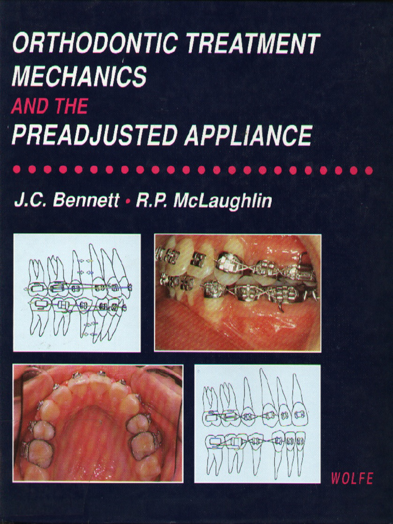 Orthodontic Treatment Mechanics and The Pre Adjusted Appliance | PDF