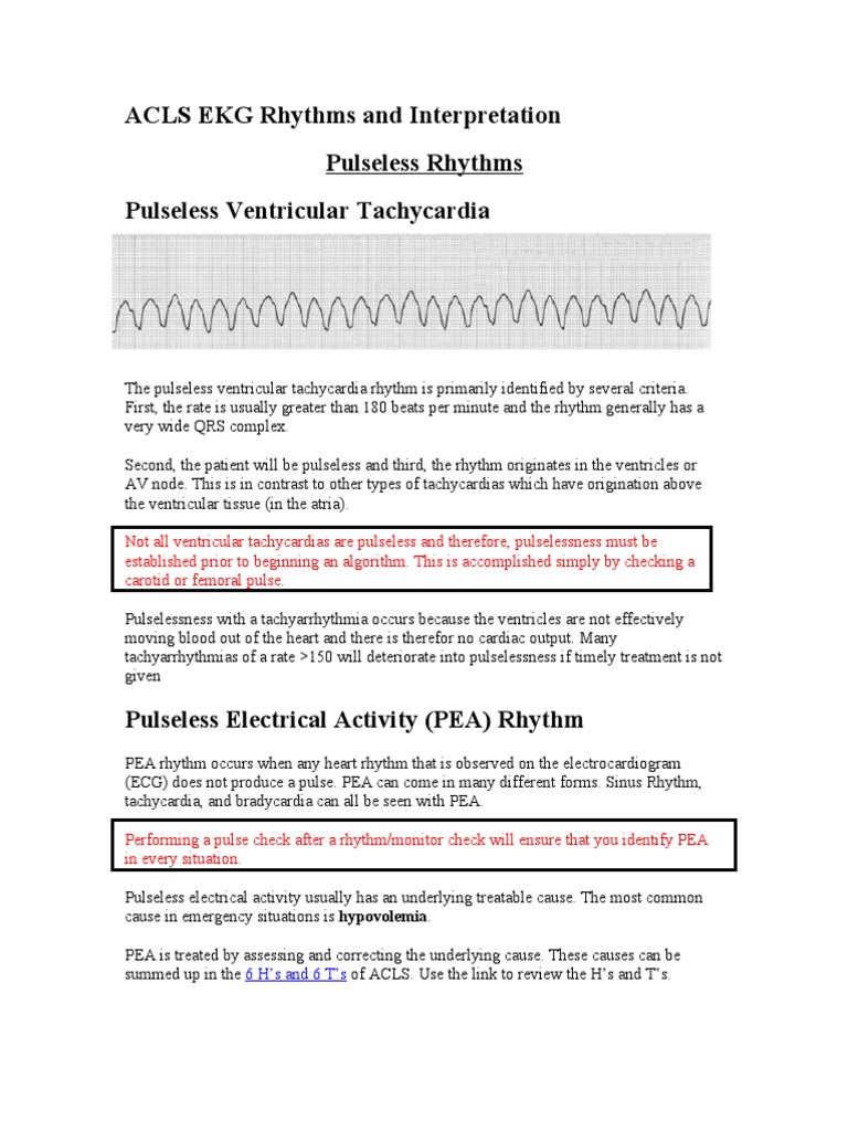 Acls Ekg Rhythms And Interpretation Heart Electrocardiography