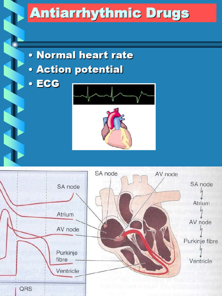 Understanding Antiarrhythmic Drugs | PDF | Electrocardiography | Heart