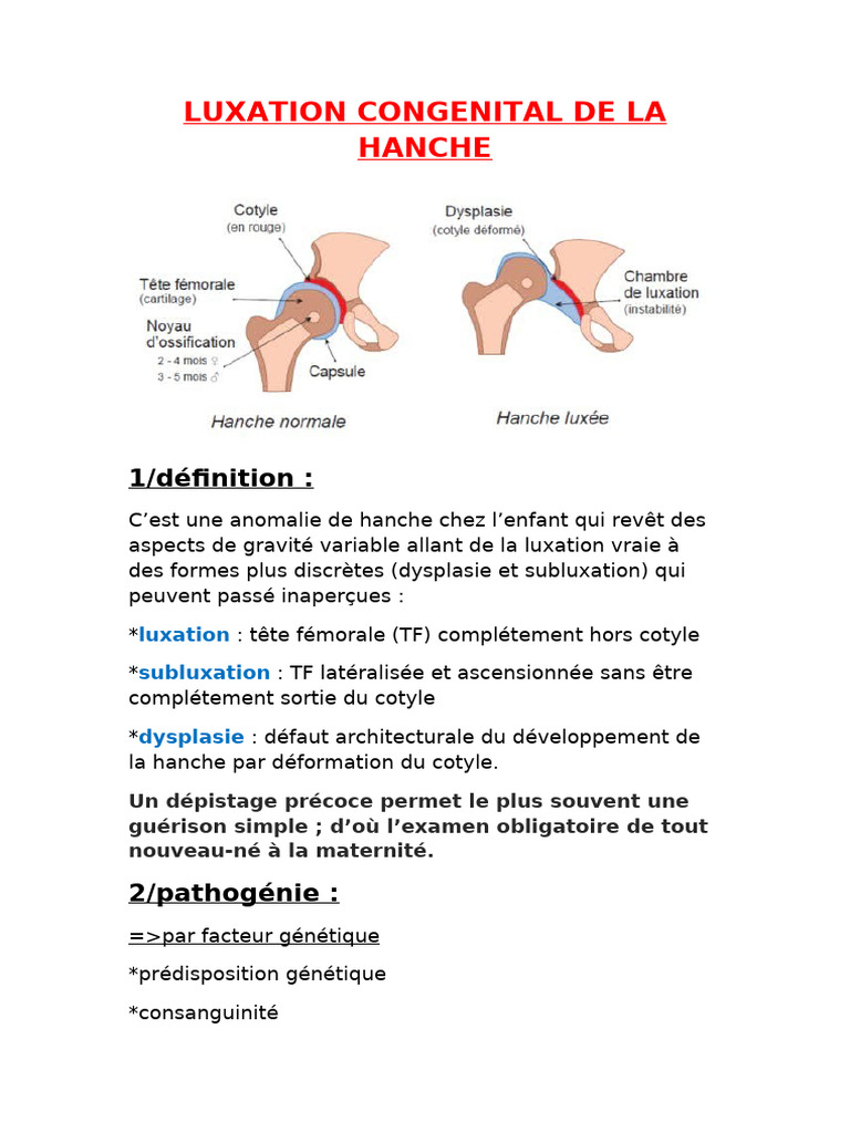 Luxation congénitale de la hanche : guide complet | PDF | Appareil ...