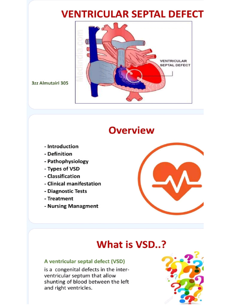 VSD | PDF