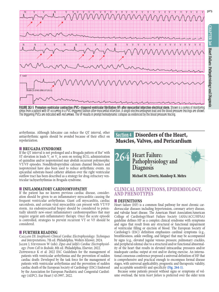 Heart Failure: Causes and Diagnosis | PDF | Heart Failure | Heart