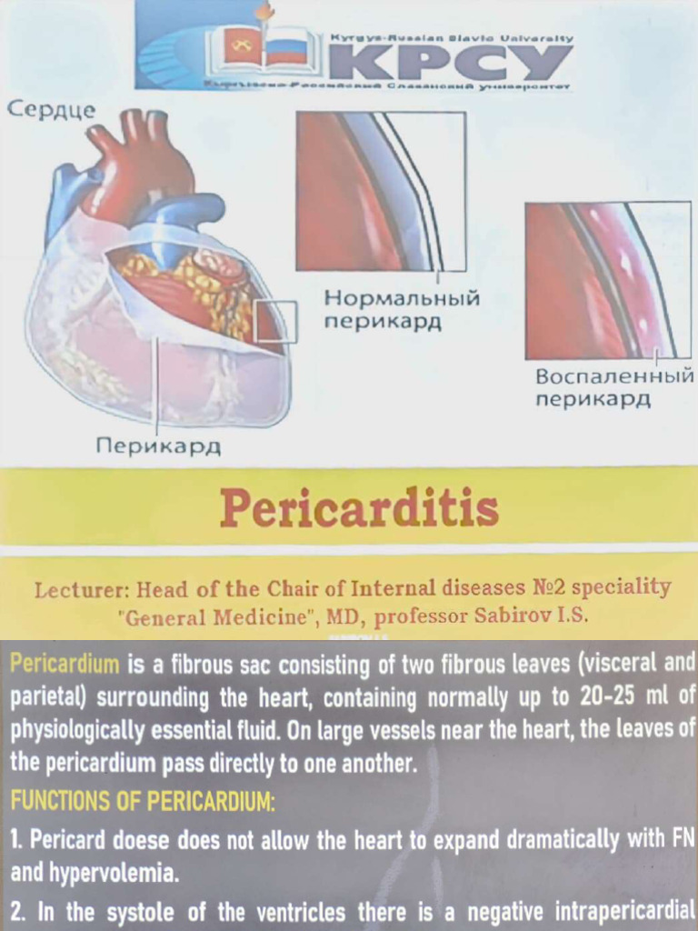 Pericarditis | PDF