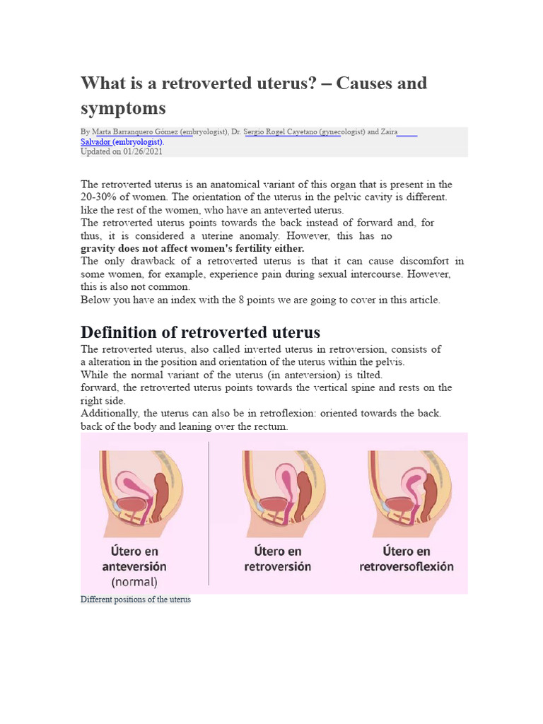 Understanding Retroverted Uterus: Causes & Symptoms | PDF | Uterus ...
