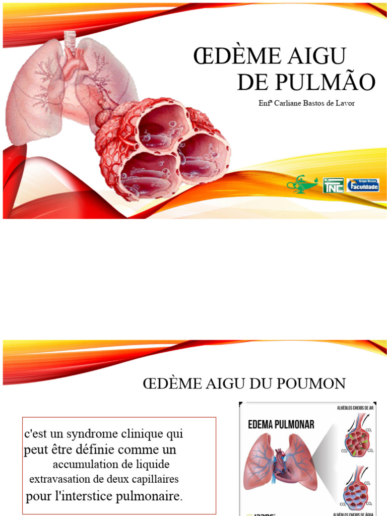 Œdème Aigu du Poumon : Causes et Traitements | PDF | Poumon | Respiration