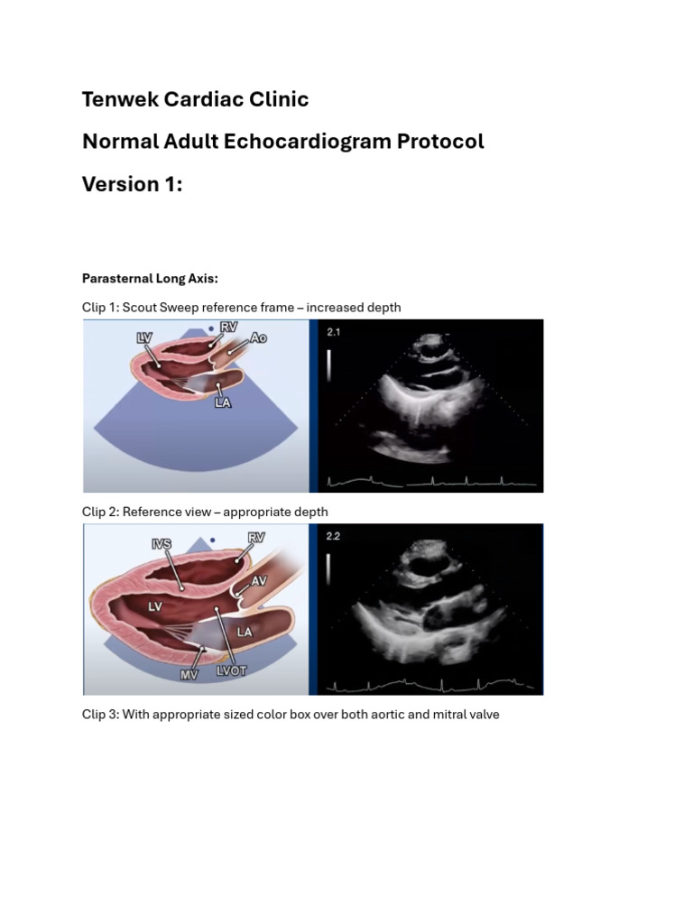 Normal Adult Echocardiogram Protocol | PDF