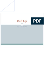 Cleft Lip Facts