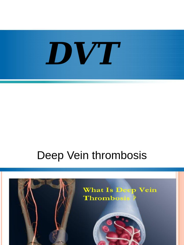Understanding Deep Vein Thrombosis (DVT) | PDF | Thrombosis | Vein