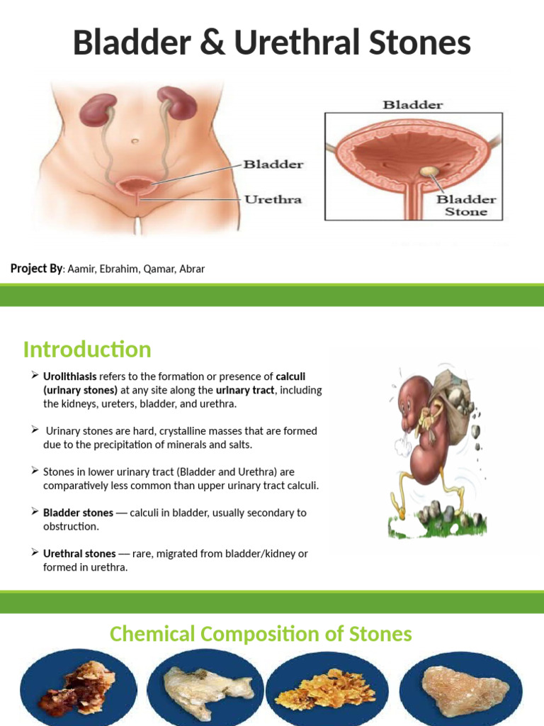 Bladder and Urethral Stones Edit | PDF | Genitourinary System | Urology
