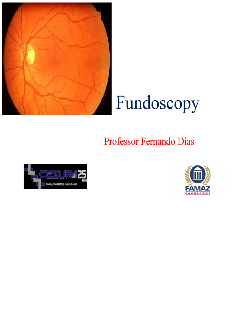Fundoscopy | PDF | Medical Specialties | Ophthalmology