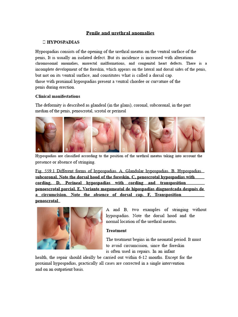 Understanding Penile and Urethral Anomalies | PDF | Testicle ...
