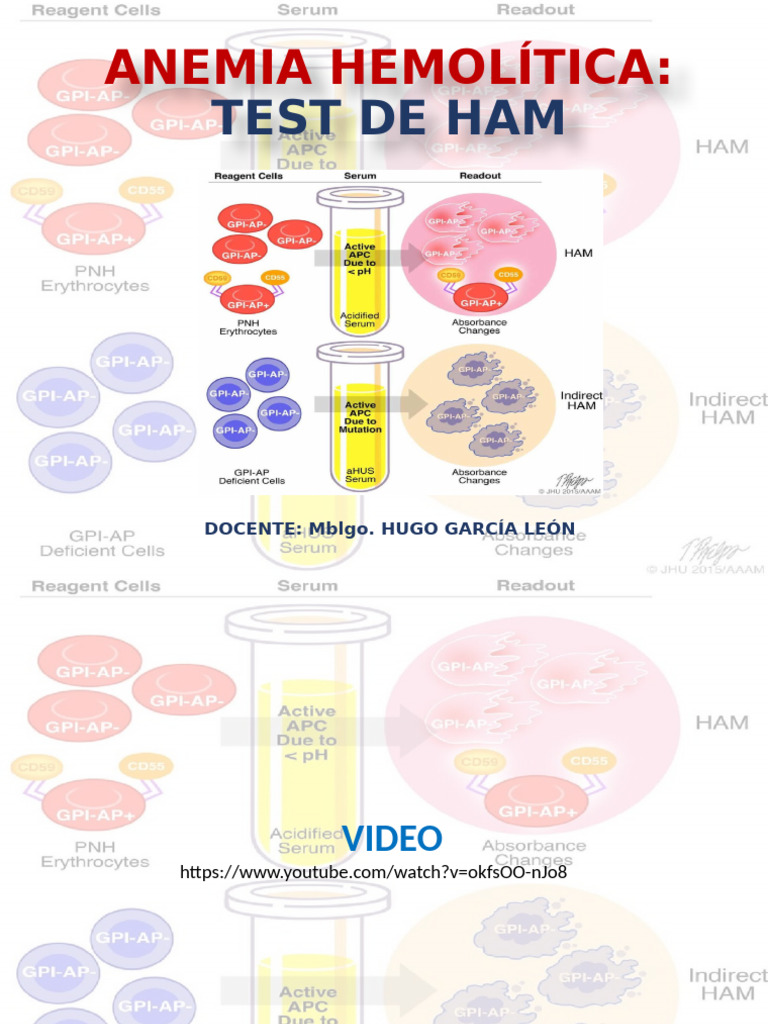 Test de Ham para Anemia Hemolítica | PDF