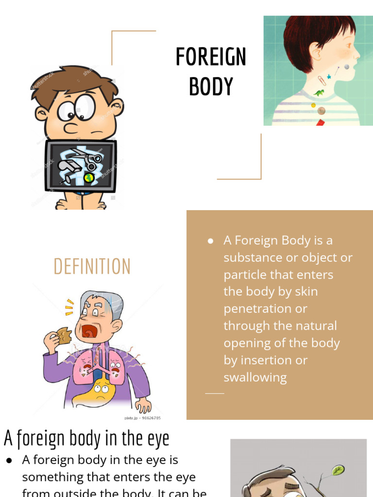 Foreign Body Management in Medical Emergencies | PDF | Medical ...