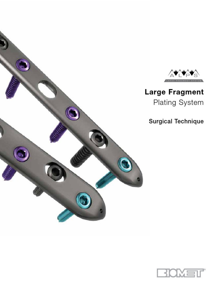 Large Fragment Plating Surgical Guide | PDF | Screw | Bone