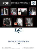 TOGD : Indications et Techniques | PDF | Œsophage | Estomac