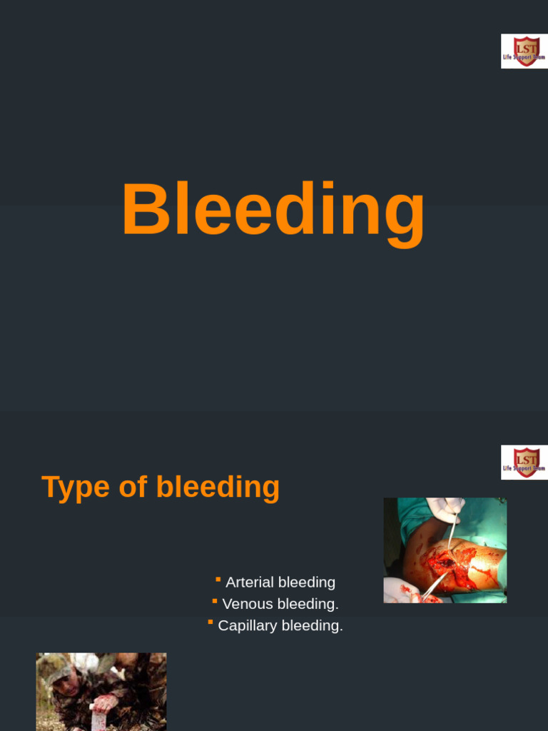 Bleeding, Shock, Burn Updated | PDF | Burn | Bleeding