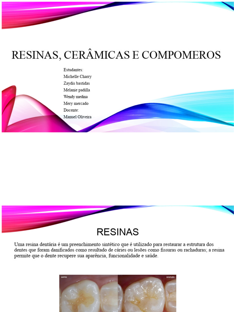 Resinas, Cerâmicas e Compômeros Dentários | PDF | Dente humano | Metais