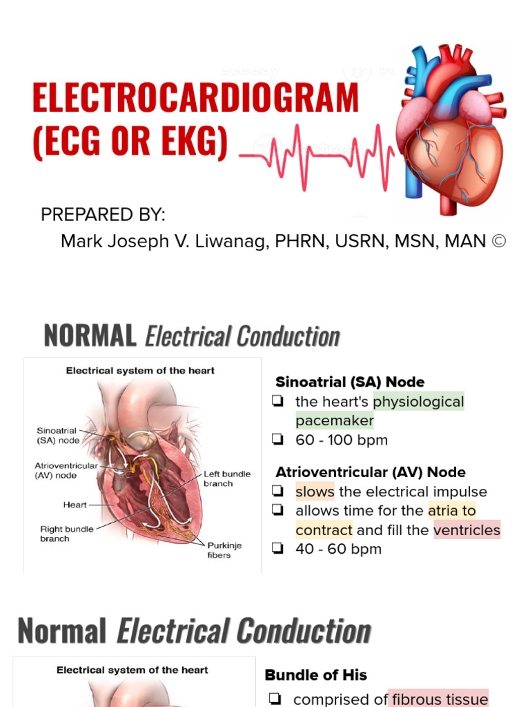 Understanding ECG: Basics & Interpretation | PDF | Electrocardiography ...