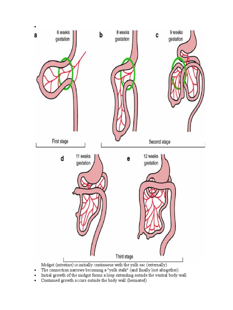 Mal Rotation | PDF | Gastrointestinal Tract | Gastroenterology