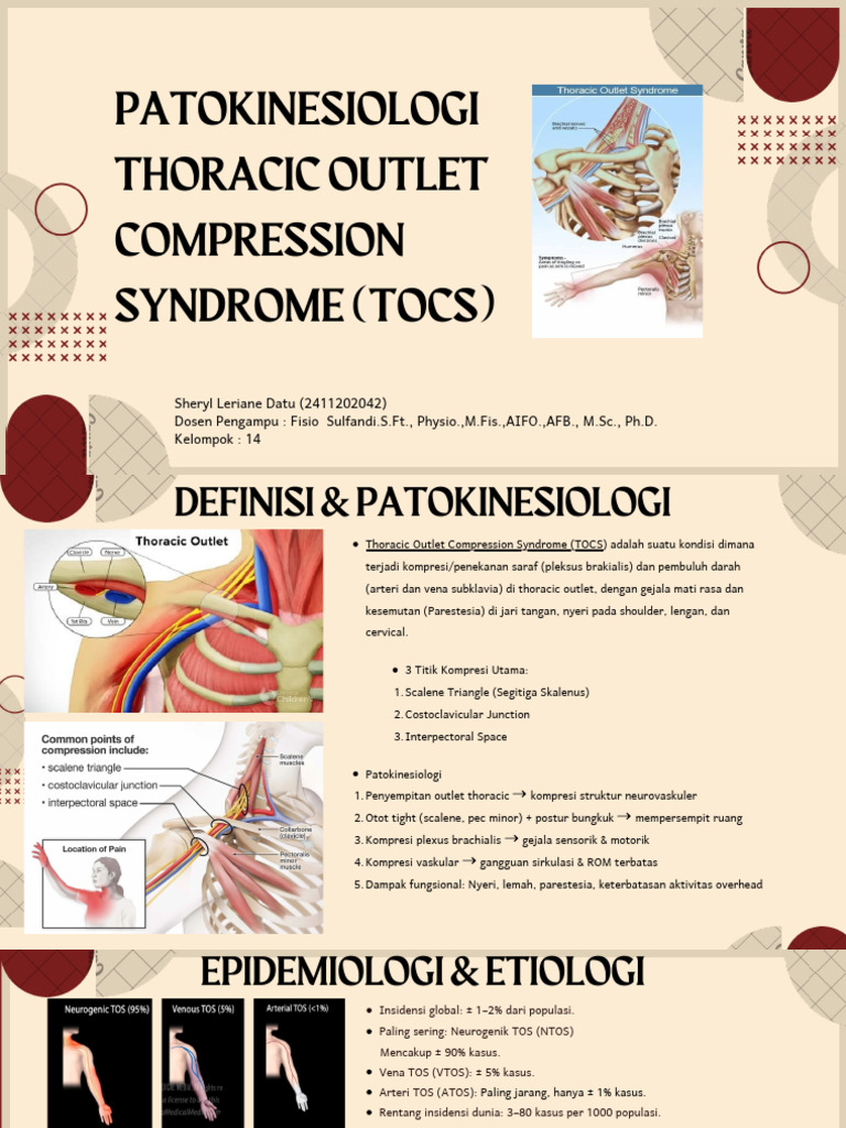 Sindrom Kompresi Thoracic Outlet | PDF