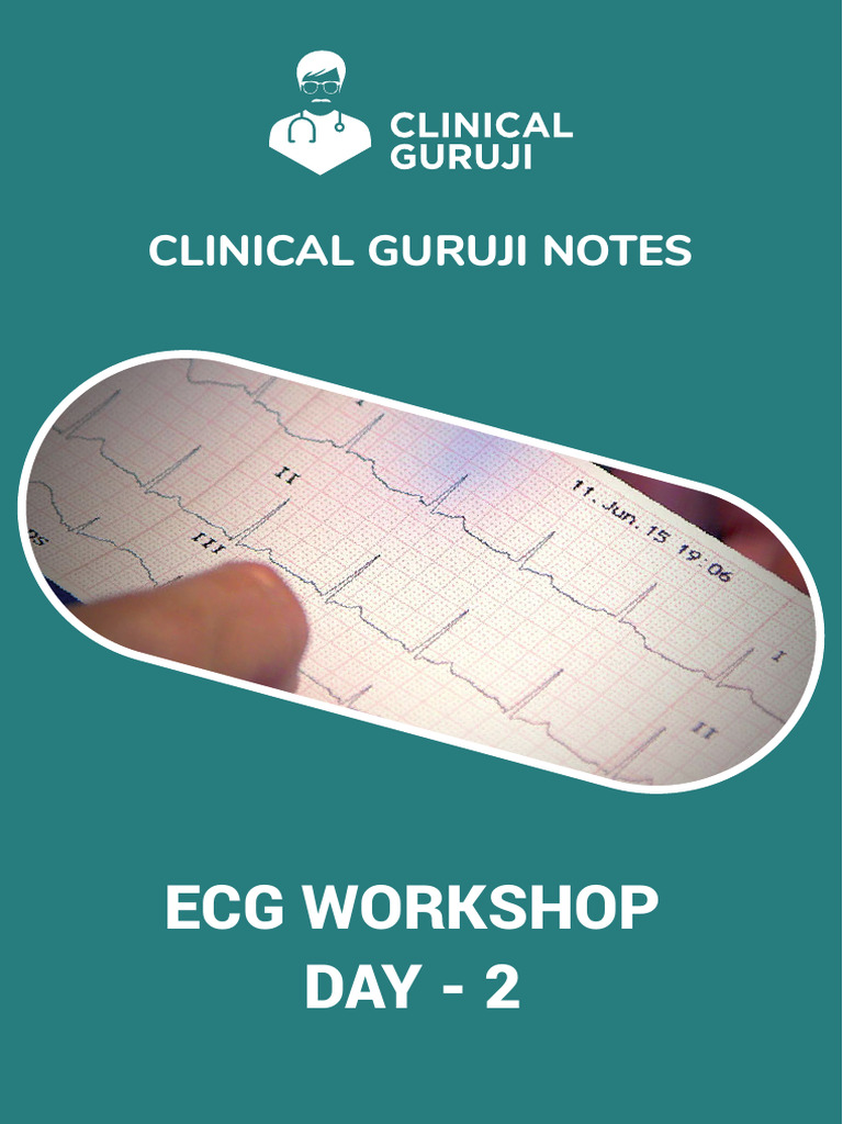 ECG Workshop Day 2: Arrhythmias Explained | PDF | Electrocardiography ...