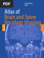 Management of Cerebral SOL Pathway | PDF | Brain Tumor | Ct Scan