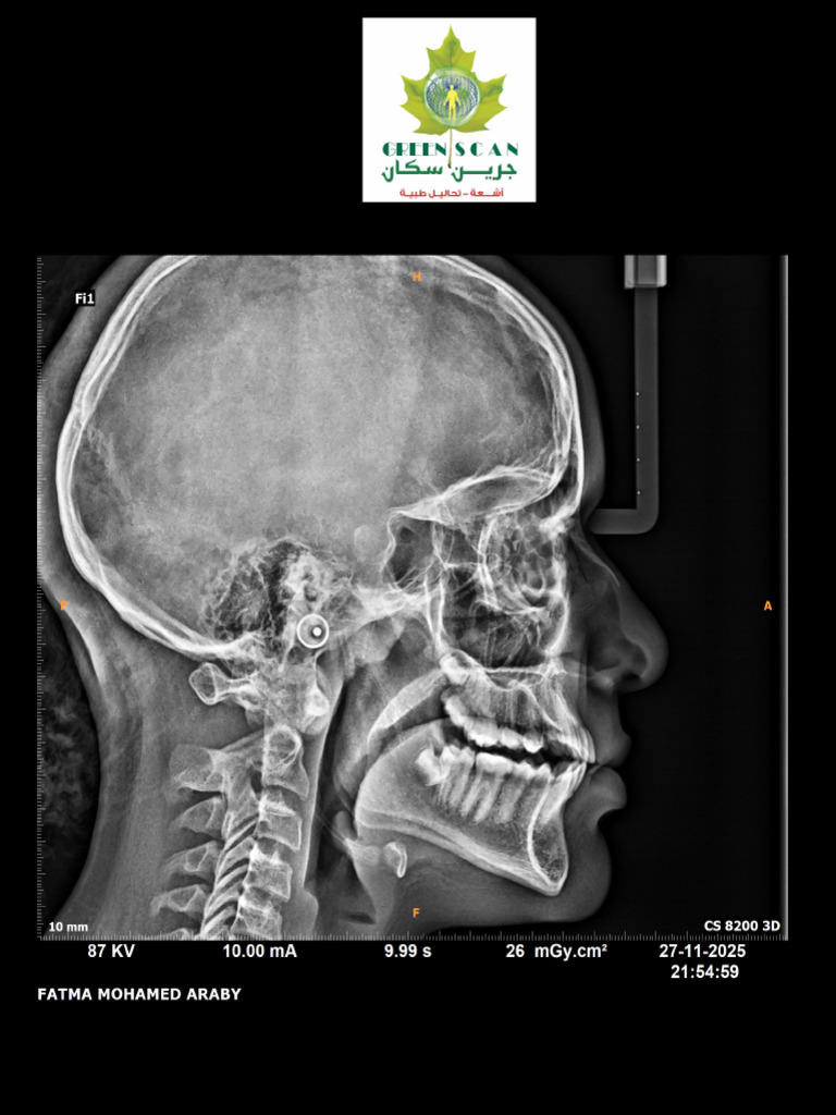 Fatma Mohamed Araby ( Ceph ) | PDF