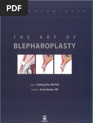 The Art of Blepharoplasty - InChang Cho - Anna's Archive | PDF