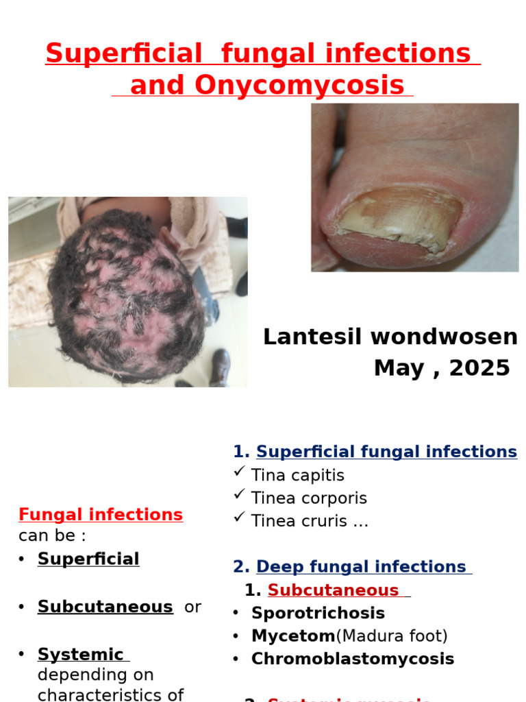 Superficial Fungal Infections Overview | PDF | Animal Diseases ...
