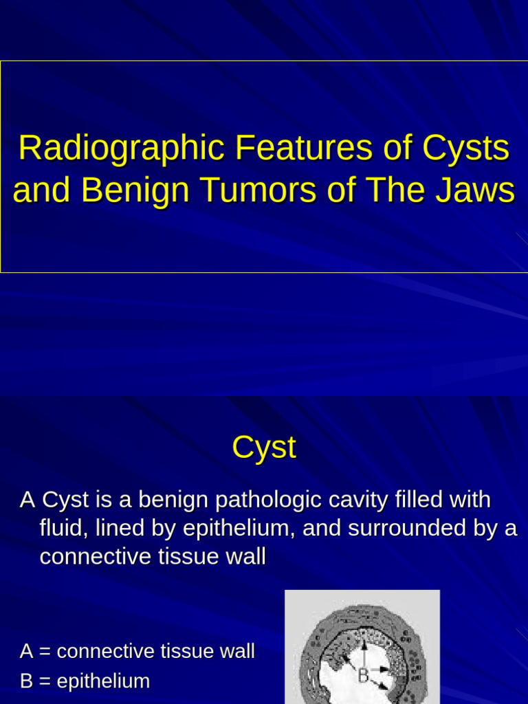Radiographic Cysts&Tumor | PDF