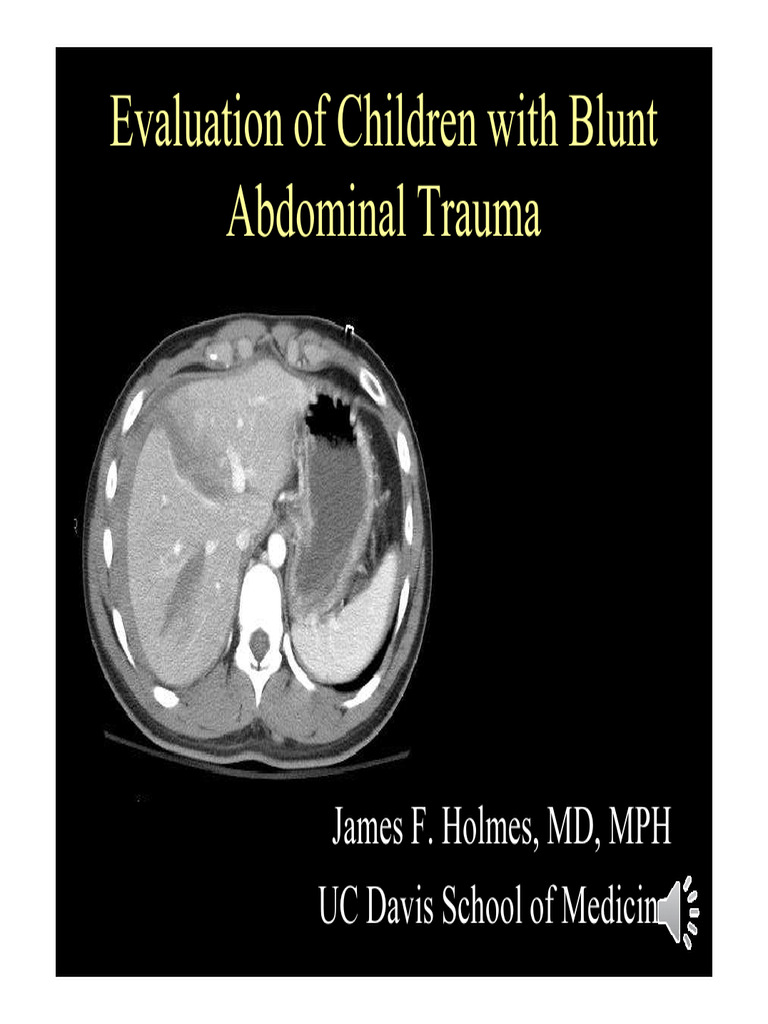 Pediatric Blunt Abdominal Trauma Evaluation | PDF | Ct Scan | Clinical ...