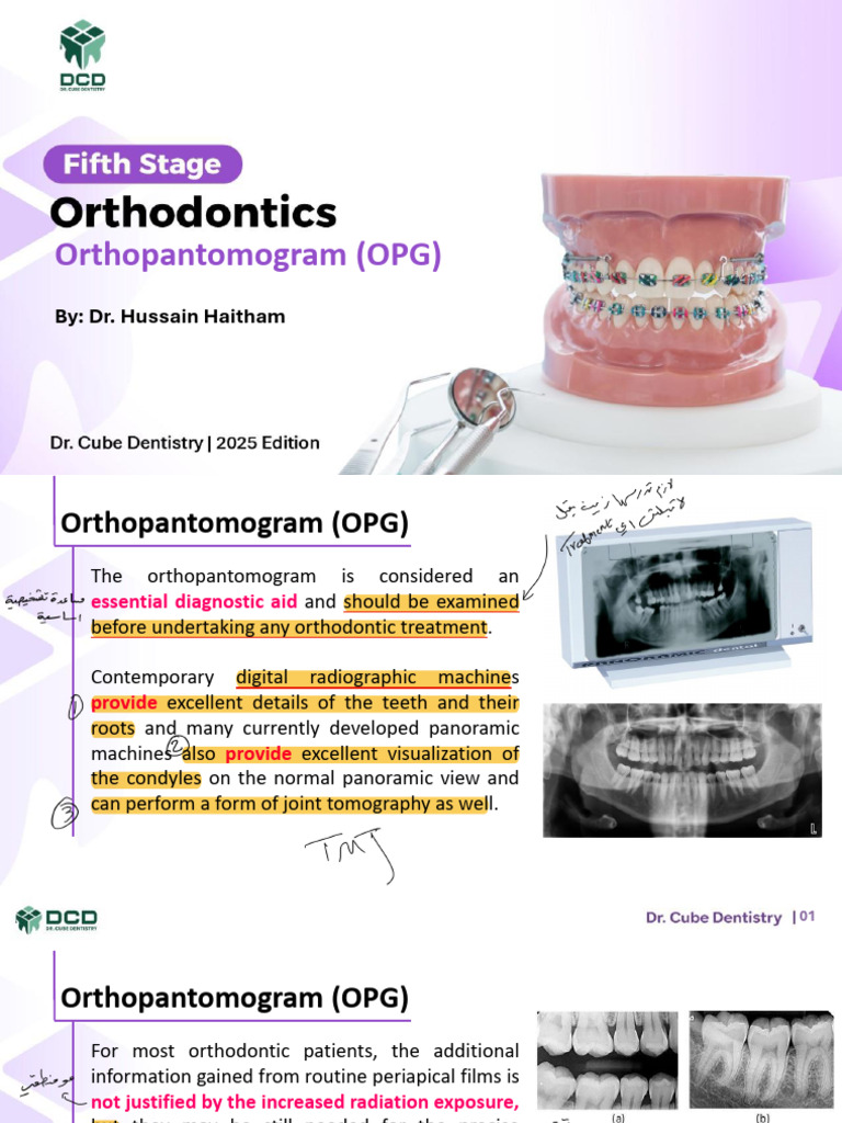 Understanding Orthopantomograms (OPG) | PDF | Medical Specialties ...